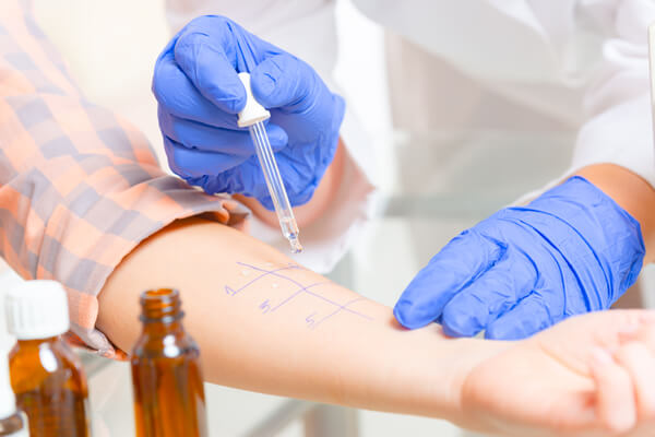 Allergy Treatment Schaumburg Testing Skypoint Medical